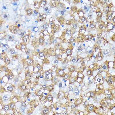 Immunohistochemistry-Paraffin: Casein Kinase 1 alpha Antibody (9O4L9) [NBP3-16807] - Immunohistochemistry of paraffin-embedded rat liver using Casein Kinase 1 alpha (Casein Kinase 1 alpha) Rabbit mAb (NBP3-16807) at dilution of 1:100 (40x lens).Perform microwave antigen retrieval with 10 mM Tris/EDTA buffer pH 9.0 before commencing with IHC staining protocol.