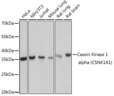 Western Blot: Casein Kinase 1 alpha Antibody (9O4L9) [NBP3-16807] - Western blot analysis of extracts of various cell lines, using Casein Kinase 1 alpha (Casein Kinase 1 alpha) Rabbit mAb (NBP3-16807) at 1:1000 dilution. Secondary antibody: HRP Goat Anti-Rabbit IgG (H+L) at 1:10000 dilution. Lysates/proteins: 25ug per lane. Blocking buffer: 3% nonfat dry milk in TBST. Detection: ECL Basic Kit. Exposure time: 1s.