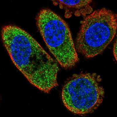 Immunocytochemistry/Immunofluorescence: Casein Kinase 1 alpha Antibody [NBP2-57137] - Staining of human cell line PC-3 shows localization to cytosol. Antibody staining is shown in green.