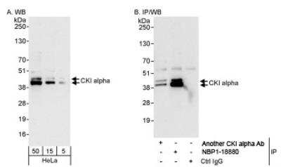 Western Blot: Casein Kinase 1 alpha Antibody [NBP1-18880] - CKI alpha by Western Blot and Immunoprecipitation:CKI alpha Antibody [NBP1-18880]- Whole cell lysate (5, 15 and 50 ug for WB; 1 mg for IP, 20% of IP loaded) from HeLa cells. Affinity purified rabbit anti-CKI alpha antibody used for WB at 0.04 ug/ml (A) and 1 ug/ml (B) and used for IP at 3 ug/mg lysate. CKI alpha was also immunoprecipitated another by rabbit anti-CKI alpha antibody which recognizes an upstream epitope.