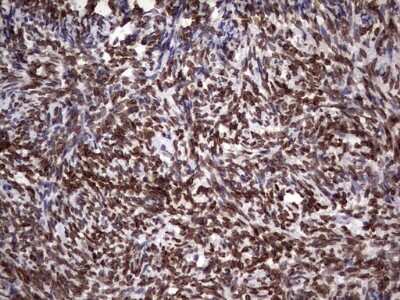 Immunohistochemistry: Casein Kinase 1 epsilon Antibody (5D4) [NBP2-46377] - Analysis of Human Ovary tissue. (Heat-induced epitope retrieval by 1 mM EDTA in 10mM Tris, pH8.5, 120C for 3min)