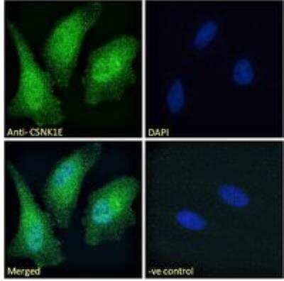 Immunocytochemistry/Immunofluorescence: Casein Kinase 1 epsilon Antibody [NB100-93388] - Immunofluorescence analysis of paraformaldehyde fixed HeLa cells, permeabilized with 0.15% Triton. Primary incubation 1hr (10 ug/mL) followed by Alexa Fluor 488 secondary antibody (2 ug/mL), showing nuclear and cytoplasmic staining. The nuclear stain is DAPI (blue). Negative control: Unimmunized goat IgG (10 ug/mL) followed by Alexa Fluor 488 secondary antibody (2 ug/mL).
