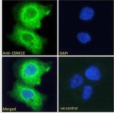 Immunocytochemistry/Immunofluorescence: Casein Kinase 1 epsilon Antibody [NB100-93388] - Immunofluorescence analysis of paraformaldehyde fixed A431 cells, permeabilized with 0.15% Triton. Primary incubation 1hr (10 ug/mL) followed by Alexa Fluor 488 secondary antibody (2 ug/mL), showing cytoplasmic staining. The nuclear stain is DAPI (blue). Negative control: Unimmunized goat IgG (10 ug/mL) followed by Alexa Fluor 488 secondary antibody (2 ug/mL).