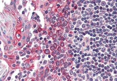 Immunohistochemistry-Paraffin: Casein Kinase 1 epsilon Antibody [NB100-93388] - Staining of paraffin embedded human tonsil tissue. Antibody at 5 ug/mL. Steamed antigen retrieval with citrate buffer pH 6, AP-staining.