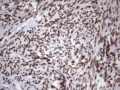 Immunohistochemistry: Casein Kinase 1 epsilon Antibody (OTI5D4) - Azide and BSA Free [NBP2-70464] - Analysis of Human endometrium tissue . (Heat-induced epitope retrieval by 1 mM EDTA in 10mM Tris, pH8.5, 120C for 3min)