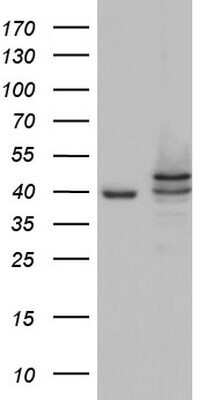 Western Blot Casein Kinase 1 epsilon Antibody (OTI5D4) - Azide and BSA Free