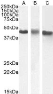 Western Blot Casein Kinase 1 epsilon Antibody