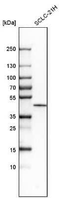 Western Blot: Casein Kinase 1 epsilon Antibody [NBP1-89712] - Analysis in human cell line SCLC-21H.