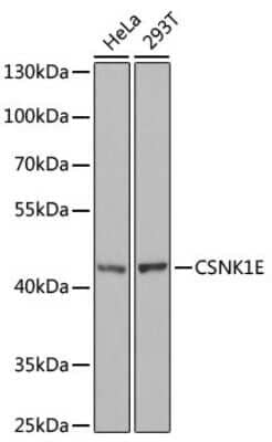 Western Blot: Casein Kinase 1 epsilon Antibody [NBP2-92968] - Analysis of extracts of various cell lines, using Casein Kinase 1 epsilon at 1:1000 dilution.Secondary antibody: HRP Goat Anti-Rabbit IgG (H+L) at 1:10000 dilution.Lysates/proteins: 25ug per lane.Blocking buffer: 3% nonfat dry milk in TBST.Detection: ECL Basic Kit .Exposure time: 90s.
