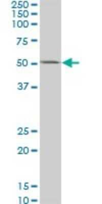 Western Blot: Casein Kinase 1 gamma 2 Antibody (2E6) [H00001455-M02] - CSNK1G2 monoclonal antibody (M02), clone 2E6. Analysis of CSNK1G2 expression in HeLa.