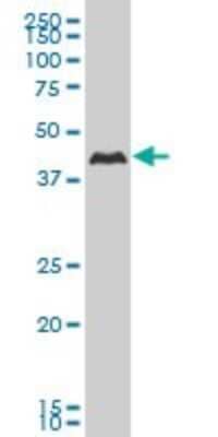 Western Blot: Casein Kinase 1 gamma 2 Antibody (2E6) [H00001455-M02] - CSNK1G2 monoclonal antibody (M02), clone 2E6 Analysis of CSNK1G2 expression in Hela S3 NE.