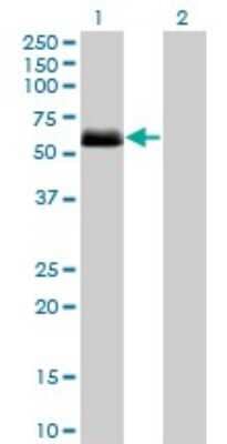 Western Blot: Casein Kinase 1 gamma 2 Antibody (2F5) [H00001455-M08] - Analysis of CSNK1G2 expression in transfected 293T cell line by CSNK1G2 monoclonal antibody (M08), clone 2F5. Lane 1: CSNK1G2 transfected lysatE (47.4 KDa). Lane 2: Non-transfected lysate.