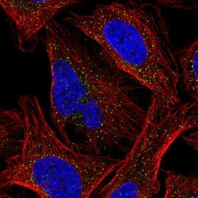 Immunocytochemistry/Immunofluorescence: Casein Kinase 1 gamma 2 Antibody [NBP2-49232] - Immunofluorescent staining of human cell line U-2 OS shows localization to vesicles.