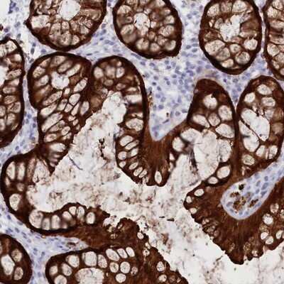 Immunohistochemistry-Paraffin: Casein Kinase 1 gamma 2 Antibody [NBP1-84461] - Staining of human colon shows strong cytoplasmic positivity in glandular cells.