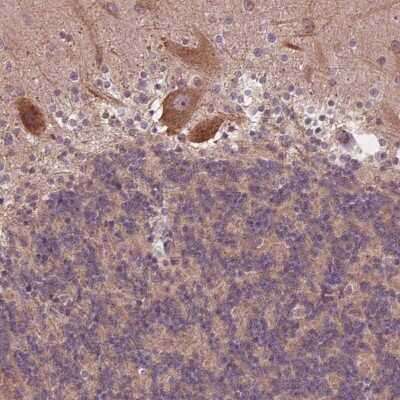Immunohistochemistry-Paraffin: Casein Kinase 1 gamma 2 Antibody [NBP2-49232] - Staining of human cerebellum shows moderate cytoplasmic positivity in Purkinje cells.
