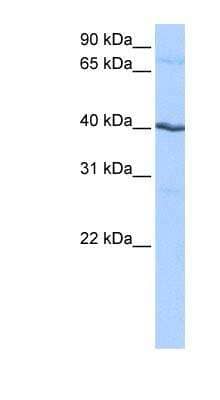 Western Blot: Casein Kinase 1 gamma 2 Antibody [NBP1-56550] - HepG2 cell lysate, concentration 0.2-1 ug/ml.