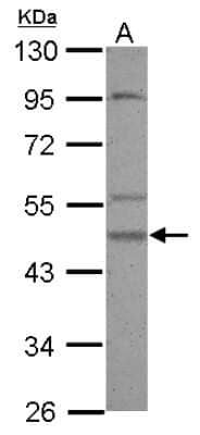 Western Blot: Casein Kinase 1 gamma 2 Antibody [NBP2-15709] - Sample (30 ug of whole cell lysate) A: A549 10% SDS PAGE gel, diluted at 1:500.