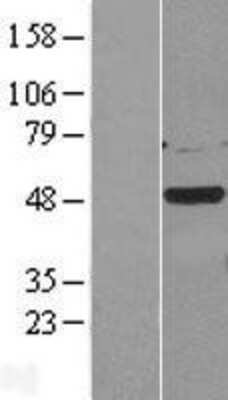 Western Blot: Casein Kinase 1 gamma 2 Overexpression Lysate (Adult Normal) [NBL1-09533] Left-Empty vector transfected control cell lysate (HEK293 cell lysate); Right -Over-expression Lysate for Casein Kinase 1 gamma 2.