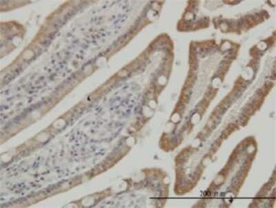 Immunohistochemistry-Paraffin: Casein Kinase 1 gamma Antibody (3D1) [H00053944-M01] - Analysis of monoclonal antibody to CSNK1G1 on formalin-fixed paraffin-embedded human small Intestine. Antibody concentration 3 ug/ml.