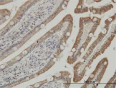 Immunohistochemistry-Paraffin: Casein Kinase 1 gamma Antibody (3D1) [H00053944-M01] - Analysis of monoclonal antibody to CSNK1G1 on formalin-fixed paraffin-embedded human small Intestine. Antibody concentration 3 ug/ml.