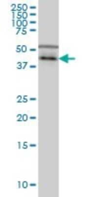 Western Blot: Casein Kinase 1 gamma Antibody (3D1) [H00053944-M01] - CSNK1G1 monoclonal antibody (M01), clone 3D1 Analysis of CSNK1G1 expression in Hela S3 NE.