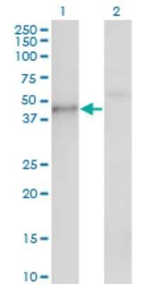 Western Blot: Casein Kinase 1 gamma Antibody (3D1) [H00053944-M01] - Analysis of CSNK1G1 expression in transfected 293T cell line by CSNK1G1 monoclonal antibody (M01), clone 3D1.Lane 1: CSNK1G1 transfected lysate(45.4 KDa).Lane 2: Non-transfected lysate.