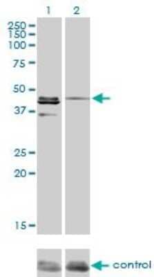 Western Blot: Casein Kinase 1 gamma Antibody (3F10) [H00053944-M03] - Western blot analysis of CSNK1G1 over-expressed 293 cell line, cotransfected with CSNK1G1 Validated Chimera RNAi or non-transfected control. Blot probed with H00053944-M03. GAPDH(36.1 kDa) used as loading control.