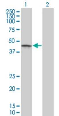 Western Blot: Casein Kinase 1 gamma Antibody (3F10) [H00053944-M03] - Analysis of CSNK1G1 expression in transfected 293T cell line by CSNK1G1 monoclonal antibody (M03), clone 3F10. Lane 1: CSNK1G1 transfected lysatE (48.511 KDa). Lane 2: Non-transfected lysate.