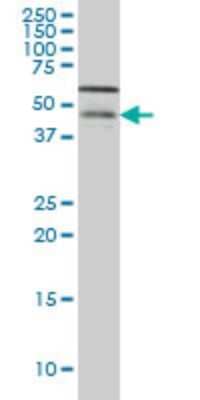 Western Blot: Casein Kinase 1 gamma Antibody (8A4) [H00053944-M04] - Analysis of CSNK1G1 expression in Hela S3 NE (Cat # L013V3).