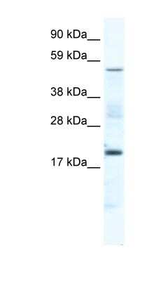 Western Blot: Casein Kinase 1 gamma Antibody [NBP1-80262] - Titration: 5.0ug/ml, Positive Control: SP2/0 cell lysate.