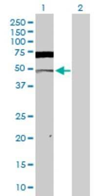 Western Blot: Casein Kinase 2 alpha Antibody [H00001457-D01P] - Analysis of CSNK2A1 expression in transfected 293T cell line by CSNK2A1 polyclonal antibody.Lane 1: CSNK2A1 transfected lysate(45.10 KDa).Lane 2: Non-transfected lysate.