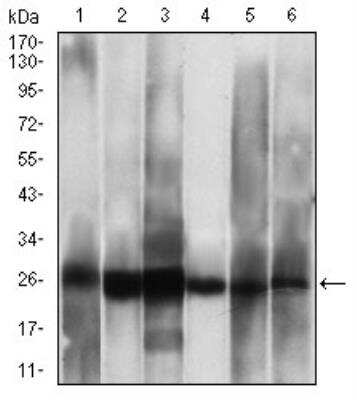 Western Blot: Casein Kinase 2 beta Antibody (1H8A5) [NBP2-52450] - Analysis using CSNK2B mouse mAb against Hela (1), Jurkat (2), C6 (3), MCF-7 (4), SK-N-SH (5), NTERA-2 (6) cell lysate.