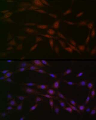 Immunocytochemistry/Immunofluorescence: Casein Kinase 2 beta Antibody (9T5J10) [NBP3-16264] - Immunofluorescence analysis of NIH-3T3 cells using Casein Kinase 2 beta (CSNK2B) Rabbit mAb (NBP3-16264) at dilution of 1:100 (40x lens). Blue: DAPI for nuclear staining.