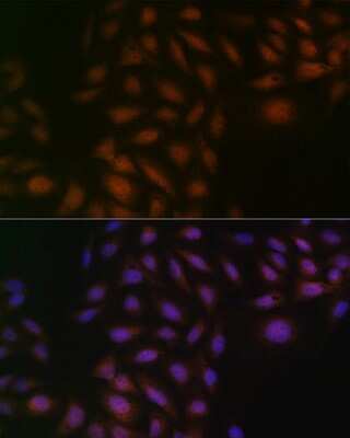 Immunocytochemistry/Immunofluorescence: Casein Kinase 2 beta Antibody (9T5J10) [NBP3-16264] - Immunofluorescence analysis of U-2 OS cells using Casein Kinase 2 beta (CSNK2B) Rabbit mAb (NBP3-16264) at dilution of 1:100 (40x lens). Blue: DAPI for nuclear staining.