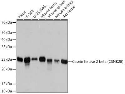 Western Blot: Casein Kinase 2 beta Antibody (9T5J10) [NBP3-16264] - Western blot analysis of extracts of various cell lines, using Casein Kinase 2 beta (CSNK2B) Rabbit mAb (NBP3-16264) at 1:1000 dilution. Secondary antibody: HRP Goat Anti-Rabbit IgG (H+L) at 1:10000 dilution. Lysates/proteins: 25ug per lane. Blocking buffer: 3% nonfat dry milk in TBST. Detection: ECL Basic Kit. Exposure time: 3s.