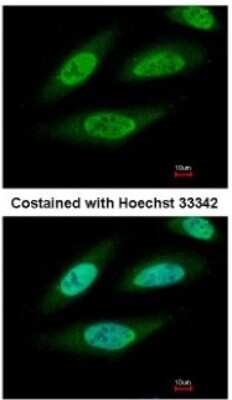 Immunocytochemistry/Immunofluorescence: Casein Kinase 2 beta Antibody [NBP2-21570] - Analysis of paraformaldehyde-fixed HeLa, using antibody at 1:500 dilution.