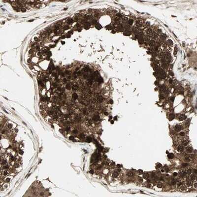 Immunohistochemistry-Paraffin: Casein Kinase 2 beta Antibody [NBP1-87483] - Staining of human testis shows strong nuclear and cytoplasmic positivity in cells in seminiferus ducts.