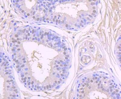 Immunohistochemistry-Paraffin: Casein Kinase 2 beta Antibody (JU37-62) [NBP2-75431] - Analysis of paraffin-embedded human breast tissue using anti-CSNK2B antibody. Counter stained with hematoxylin.