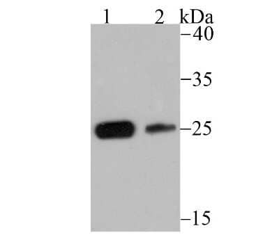 Western Blot: Casein Kinase 2 beta Antibody (JU37-62) [NBP2-75431] - Analysis of CSNK2B on SH-SY5Y (1) and 293 (2) lysate using anti-CSNK2B antibody at 1/500 dilution.