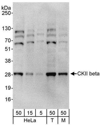 Western Blot Casein Kinase 2 beta Antibody