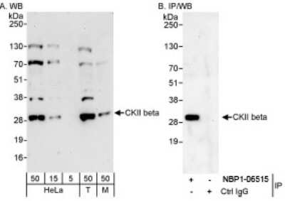 Western Blot: Casein Kinase 2 beta Antibody [NBP1-06515] - Whole cell lysate from HeLa (5, 15 and 50 ug for WB; 1 mg for IP, 20% of IP loaded), HEK293T (T; 50 ug) and mouse NIH 3T3 (M; 50 ug) cells. Antibodies: Affinity purified rabbit anti-CKII beta antibody used for WB at 0.04 ug/ml (A) and 1 ug/ml (B) and used for IP at 3 ug/mg lysate. Detection: Chemiluminescence with exposure times of 30 seconds (A) and 10 seconds (B).