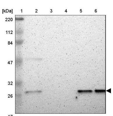 Western Blot: Casein Kinase 2 beta Antibody [NBP1-87483] - Lane 1: Marker  [kDa] 220, 112, 84, 47, 32, 26, 17.  Lane 2: Human cell line RT-4.  Lane 3: Human cell line U-251MG sp.  Lane 4: Human plasma (IgG/HSA depleted).  Lane 5: Human liver tissue.  Lane 6: Human tonsil tissue