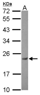 Western Blot: Casein Kinase 2 beta Antibody [NBP2-21570] - Sample (30 ug of whole cell lysate) A: U87-MG 12% SDS PAGE gel, diluted at 1:500.