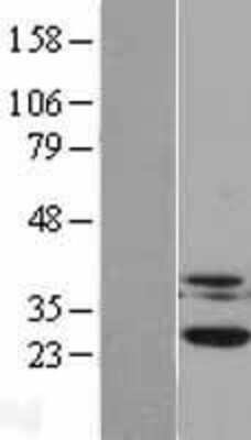 Western Blot Casein Kinase 2 beta Overexpression Lysate