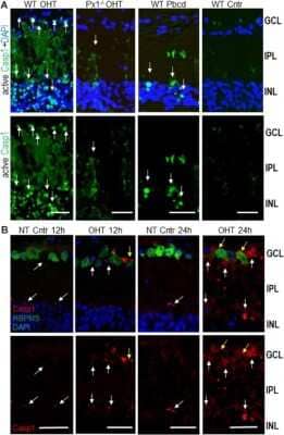 Activity of Caspase-1 in OHT-injured and normotensive control eyes. Caspase-1 was detected by intraocular injection FLICA660-labeled substrate (green) in vivo 24 h after injury. Bright labeling (arrows) is evident in cells in the GCL and inner nuclear layer (INL) layers of the OHT-challenged retinas, a diffuse labeling of cell processes located in the IPL. Caspase-1 activity is diminished in Panx1-/- (Px1-/- OHT) retinas and WT retinas treated with probenecid (WT/Pbcd) at 12 h postinjury. Image collected and cropped by CiteAb from the following publication (//www.frontiersin.org/article/10.3389/fnmol.2019.00036/full), licensed under a CC-BY license.