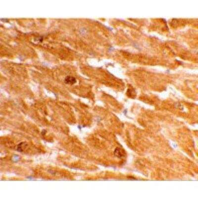 Immunohistochemistry: Caspase-12 Antibody [NBP1-76624] - Staining of human heart tissue using caspase-12 antibody (large) at 2 ug/mL.