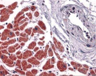 Immunohistochemistry-Paraffin: Caspase-12 Antibody [NBP2-31179] - Human heart tissue with caspase-12 antibody at 10 ug/mL.