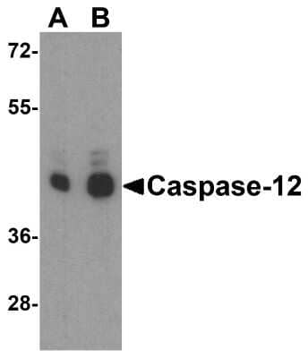 Western Blot: Caspase-12 Antibody [NBP1-76624] - Analysis of Caspase-12 expression in rat heart tissue lysate with Caspase-12 antibody at (A) 0.25 and (B) 0.5 ug/ml.