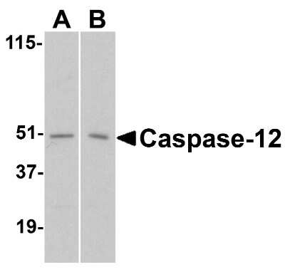 Western Blot: Caspase-12 Antibody [NBP1-77290] - Analysis of caspase-12 in (A) human and (B) mouse spleen tissue lysates with caspase-12 antibody at 1 ug/mL.