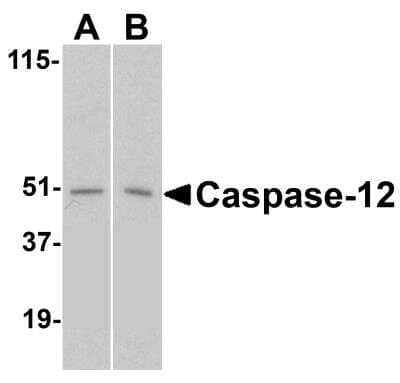 Western Blot: Caspase-12 Antibody [NBP2-31179] - Western blot analysis of caspase-12 in (A) human and (B) mouse spleen tissue lysates with caspase-12 antibody at 1 ug/mL. 